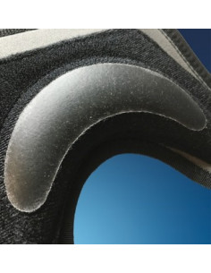 ARX Patella Luxation 2